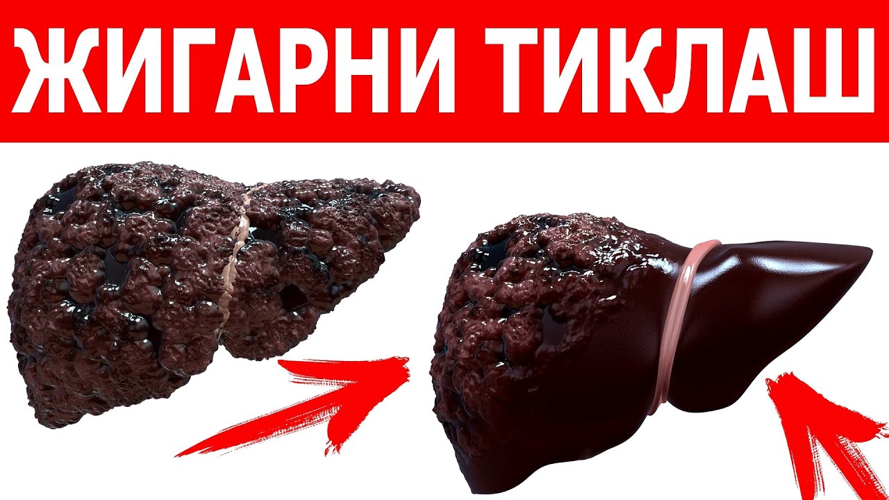 ШООК! ОДДИЙ БИР ДОНА САБЗАВОТ ЖИГАРНИ 18 ЁШ ДЕК, 90 ЁШДА ТИНИҚ КЎРИШ ХАТТО ИЧАКНИ ТИКЛАР ЭКАН!