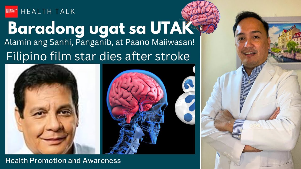 Baradong ugat sa UTAK (Cerebral Thrombosis): Alamin ang Sanhi, Panganib, at Paano Maiiwasan!