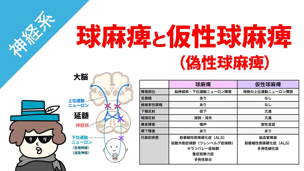 球麻痺と仮性球麻痺（偽性球麻痺）