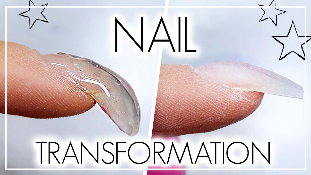 How To Correct A Hooked Nail Using Gel | Nail Transformation!