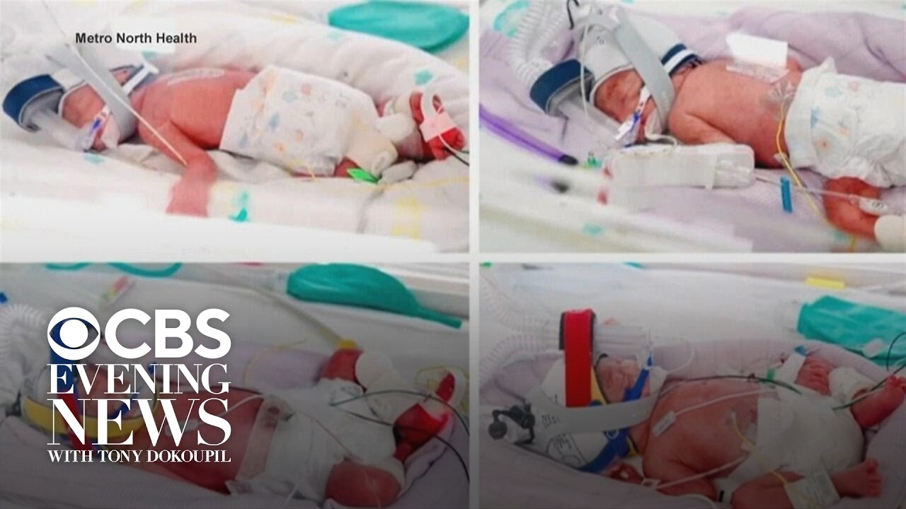 Australian woman gives birth to rare identical quadruplets