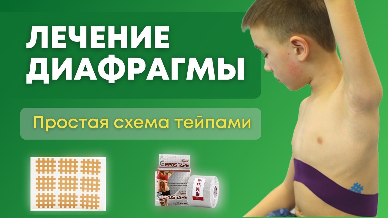 Как лечить диафрагму? Тейпирование в логопедии. Проста аппликация тейпами.
