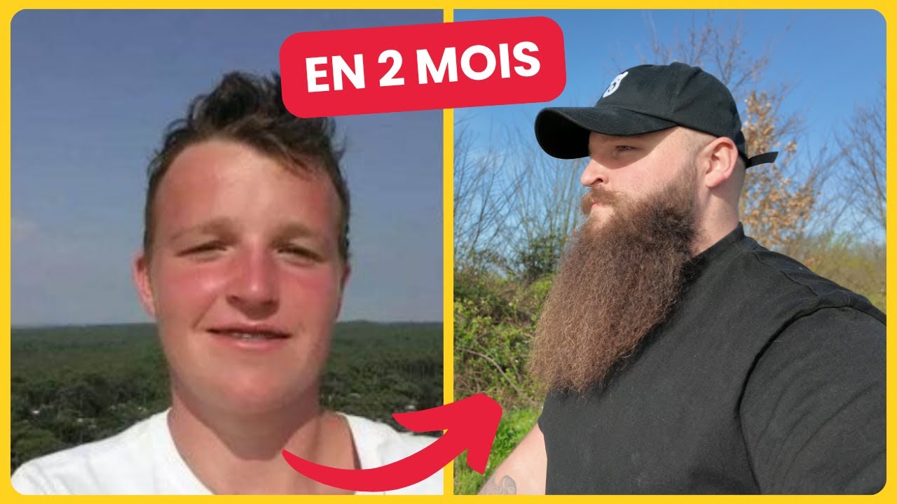 COMMENT AVOIR UNE GROSSE BARBE EN SEULEMENT 2 MOIS