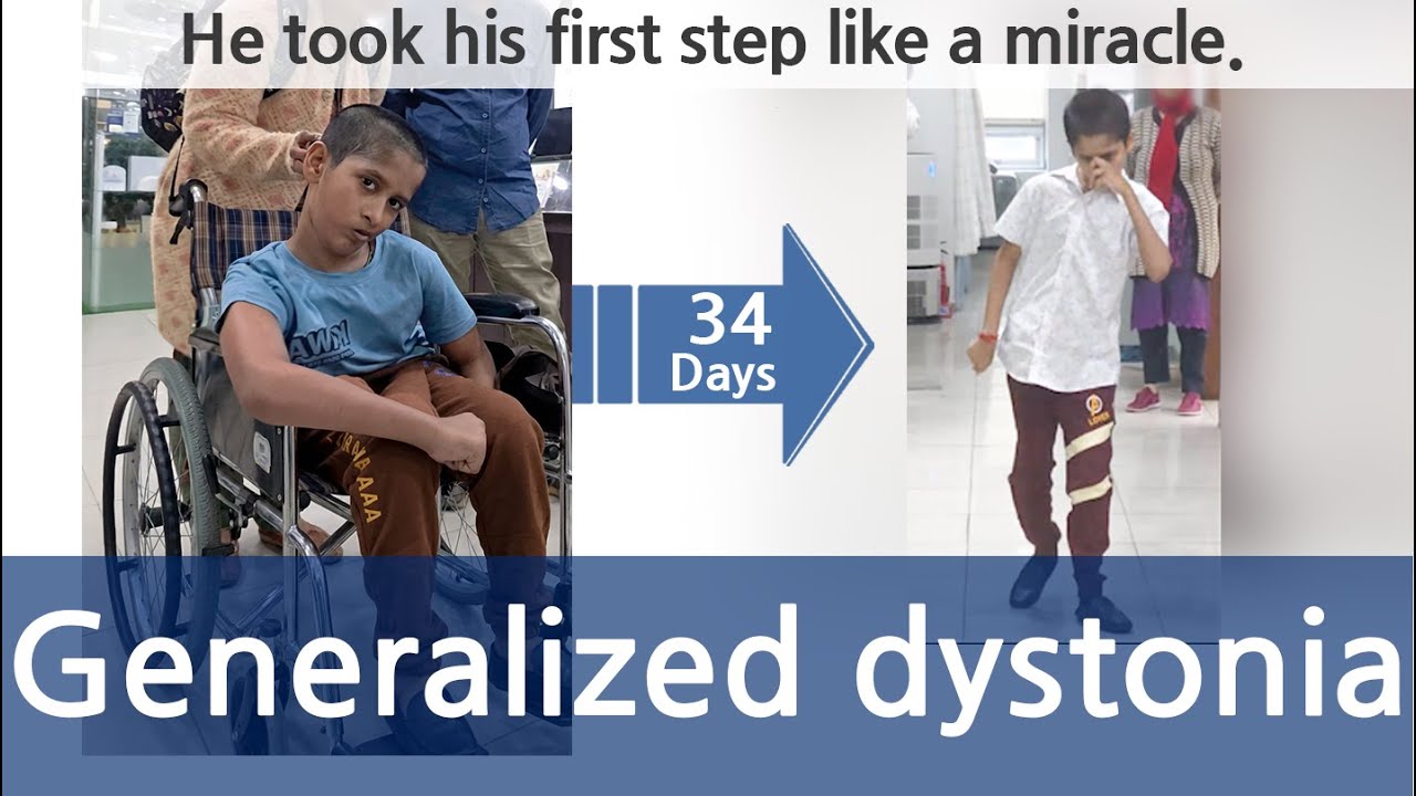 He took his first step like a miracle. Generalized dystonia / genetically mutated dystonia