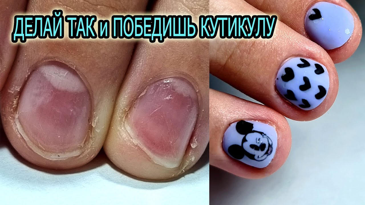 ЕСЛИ ТАК ДЕЛАТЬ то СПРАВИТЕСЬ с ВЛАЖНОЙ ЭЛАСТИЧНОЙ кутикулой КАЖДЫЙ