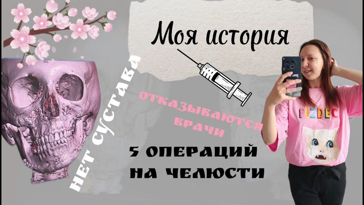 Живу без сустава. Шестая операция на челюсть. Моя история