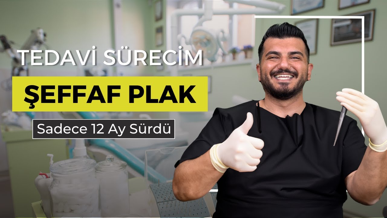Şeffaf Plak Tedavim I A'dan Z'ye Tüm Bilmeniz Gerekenler (Invisalign)