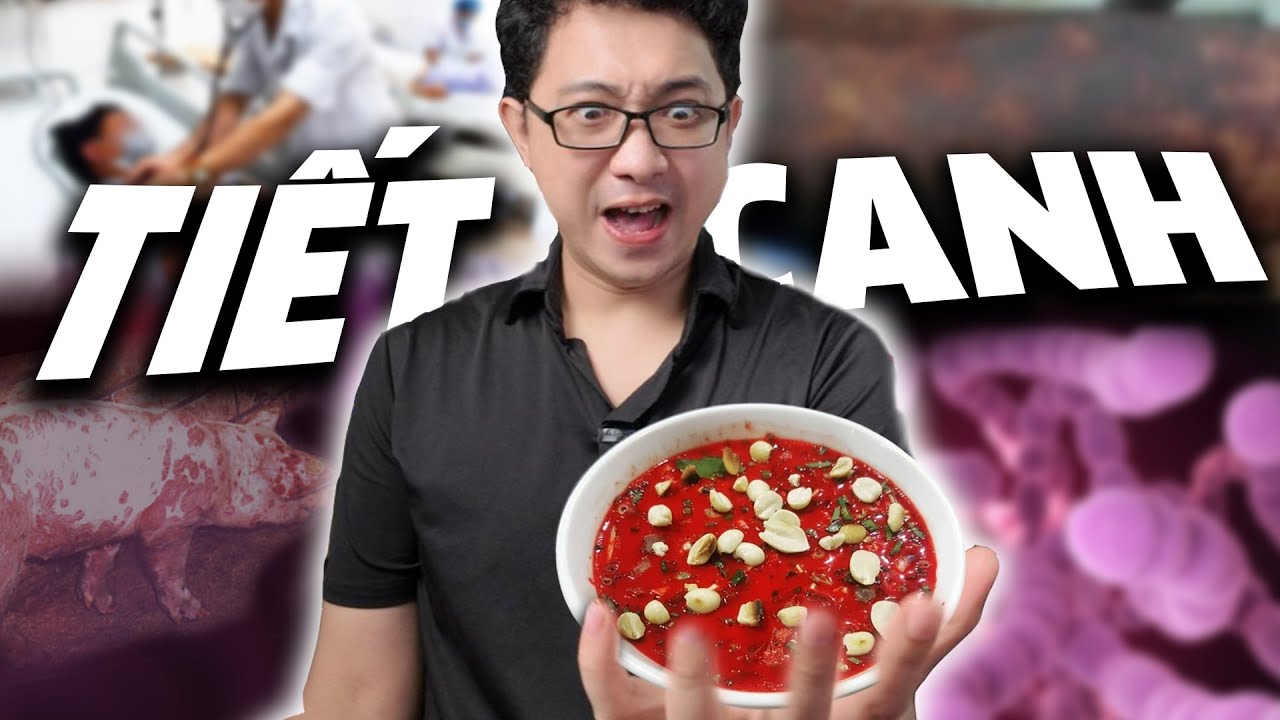 TẠI SAO BẠN NÊN 
