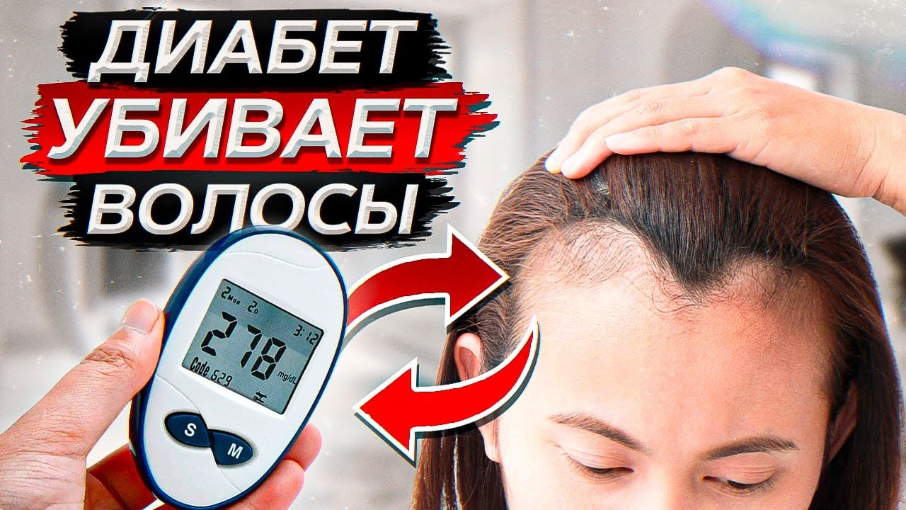 Как ДИАБЕТ может ИСПОРТИТЬ состояние ваших ВОЛОС?! / Причины инсулинорезистентности