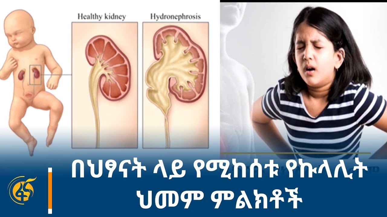 በህፃናት ላይ የሚከሰቱ የኩላሊት ህመም ምልክቶች