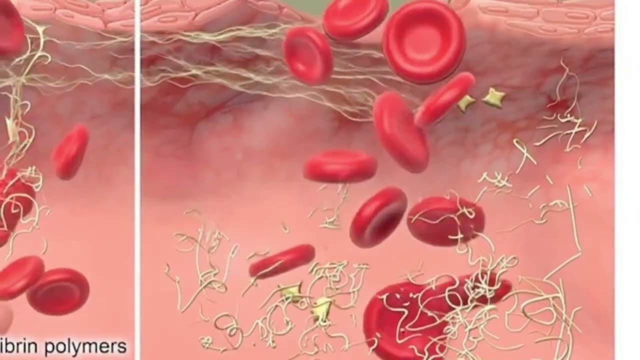 Fibrinogeno: il marcatore che collega infiammazione, coagulazione e rischio cardiovascolare.