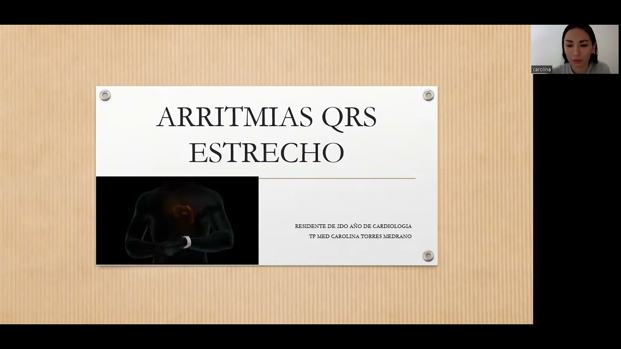 Arritmias QRS estrecho
