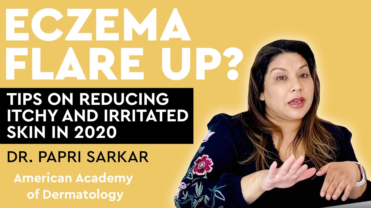 Eczema flare up? Tips on reducing itchy and irritated skin -Skin Q&A with Dr. Papri Sarkar (Part 2)
