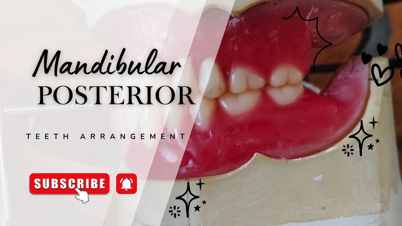 Mandibular Posterior Teeth Arrangement | Complete Step-by-Step Demonstration | Complete Denture 