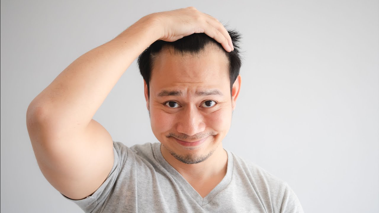 Congenital bald spot. Good for hair transplant?