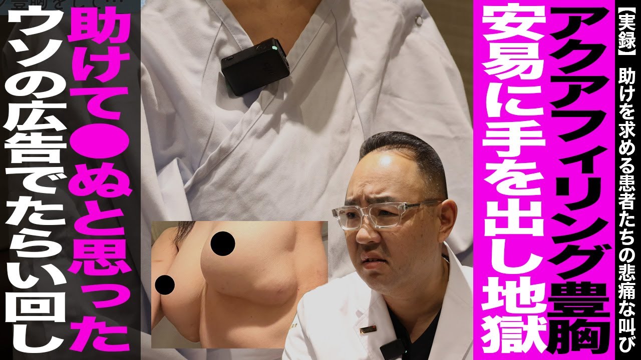 ≪実録≫安易に手を出したアクアフィリング豊胸が地獄の始まり！誰も助けてくれない！●ぬと思った。ウソばかりの広告に騙されたらい回し！助けを求める患者たちの悲痛な叫び【ドクターA（麻生泰）】