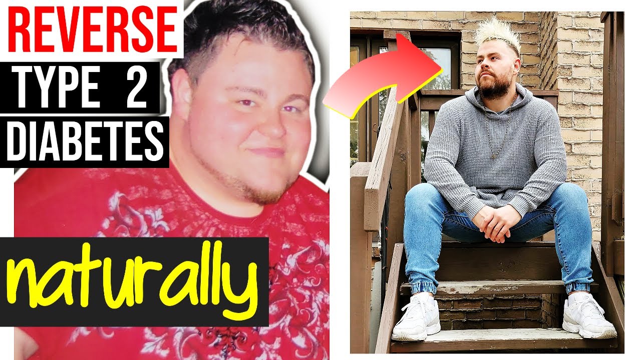 How I REVERSED Type 2 Diabetes NATURALLY (& lost 130 pounds) EASIEST METHOD