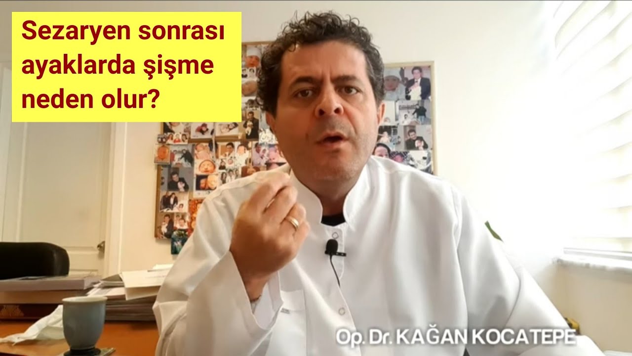 Sezaryen sonrası ayaklarda adeta 