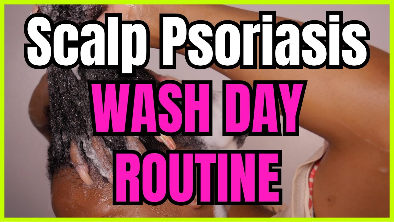 Managing Scalp Psoriasis | Wash Day Routine | How I Incorporate Natural Ingredients Into My Wash Day
