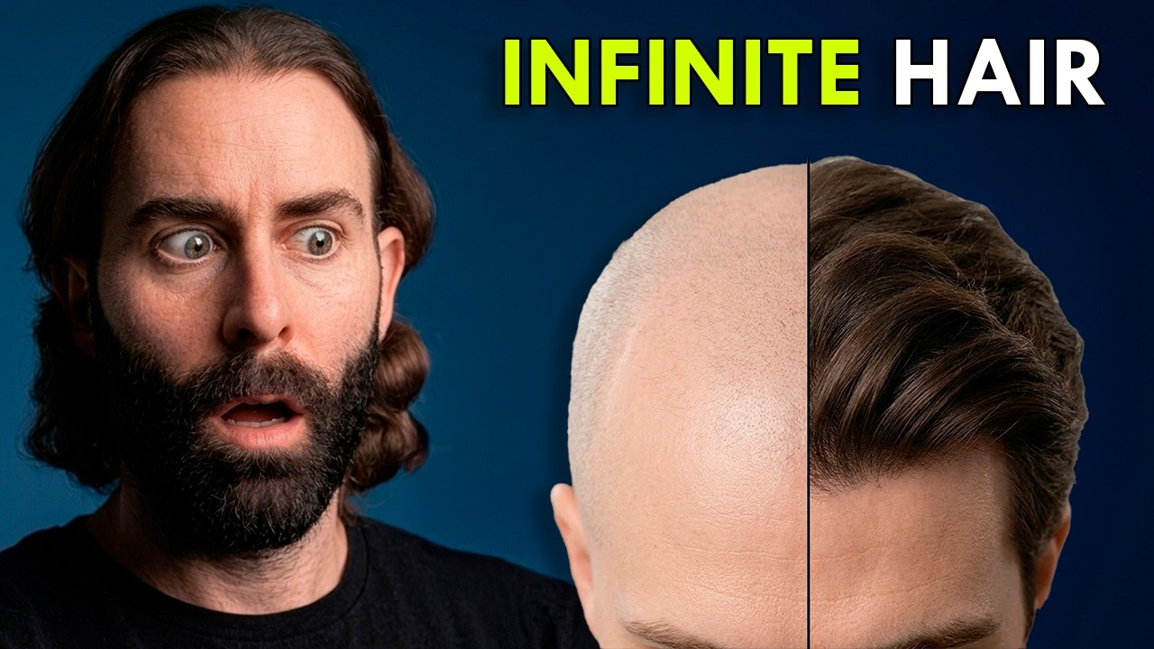 Don't Get a Hair Transplant Before Watching This (2026 Study)