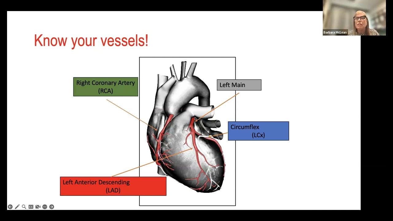WW Infero-Posterior MI 9_20