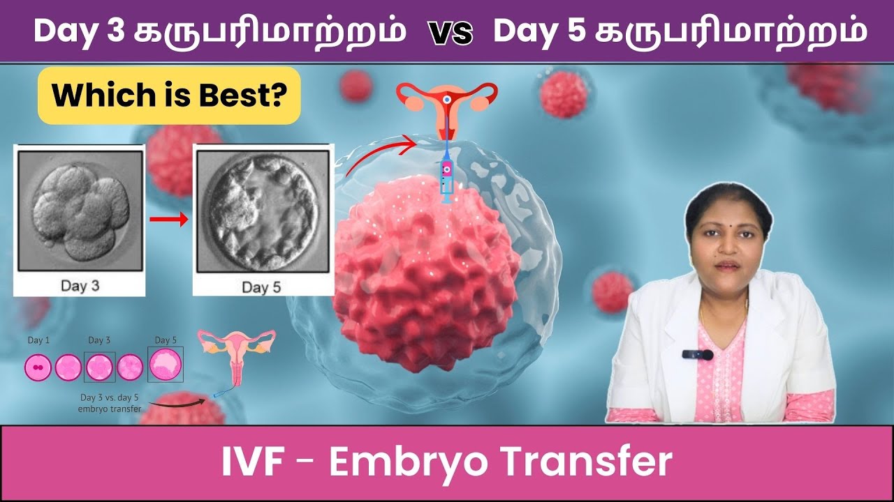Day 3 கருபரிமாற்றம் VS  Day 5 கருபரிமாற்றம் | Which is Best? | IVF Series | Fertility video Epi - 4
