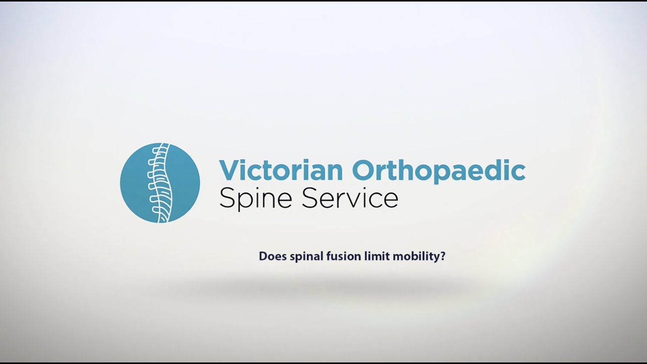 Does Spinal Fusion Limit Mobility?