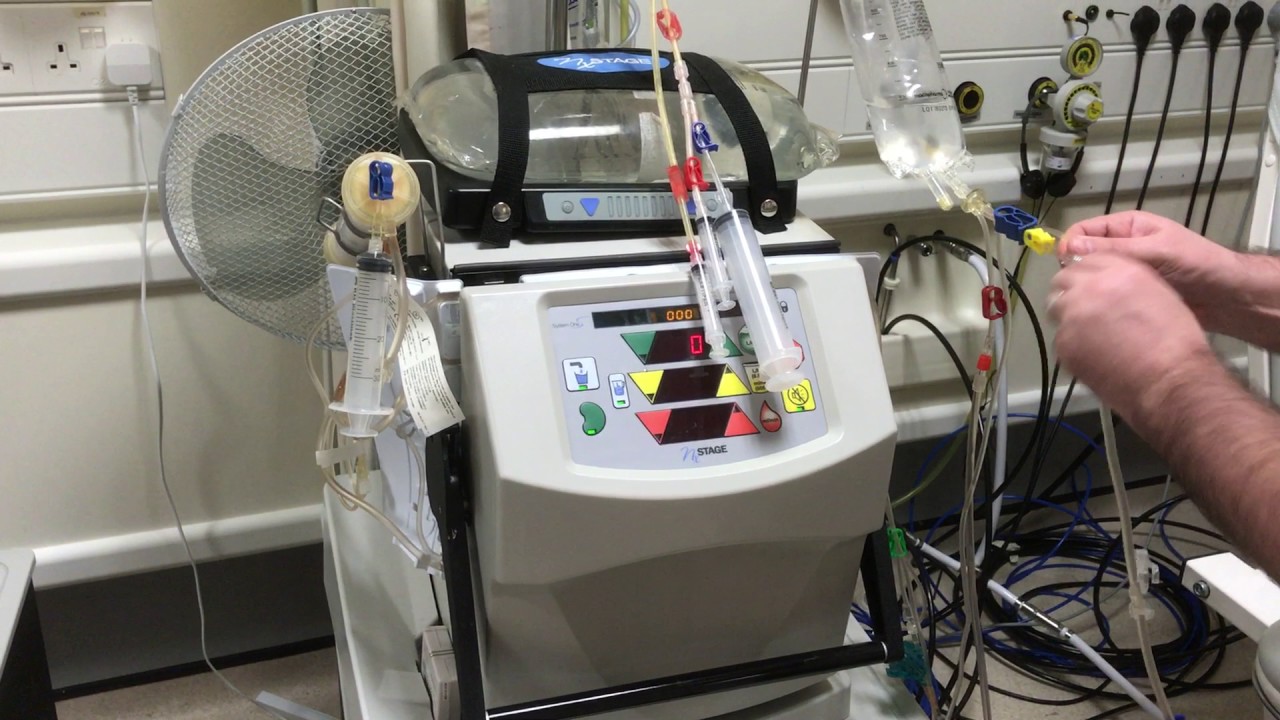 Video 7,Nxstage End Treatment
