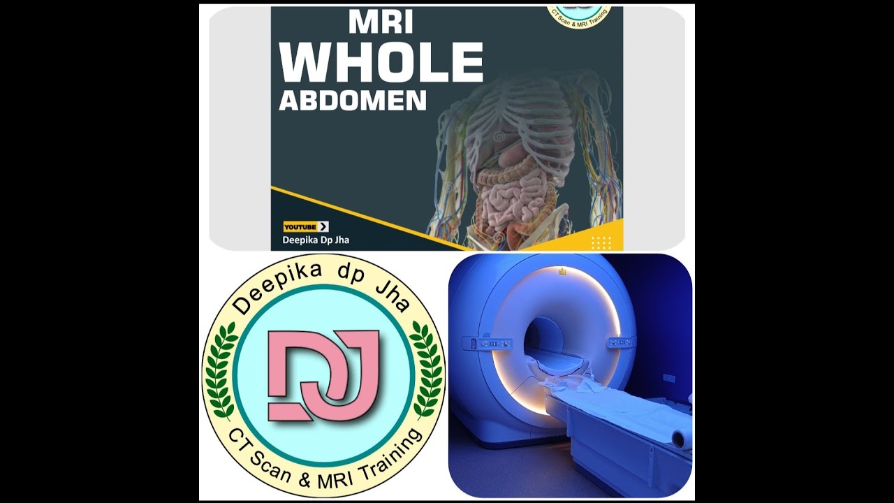 MRI whole abdomen planning and positioning in Philips 3T