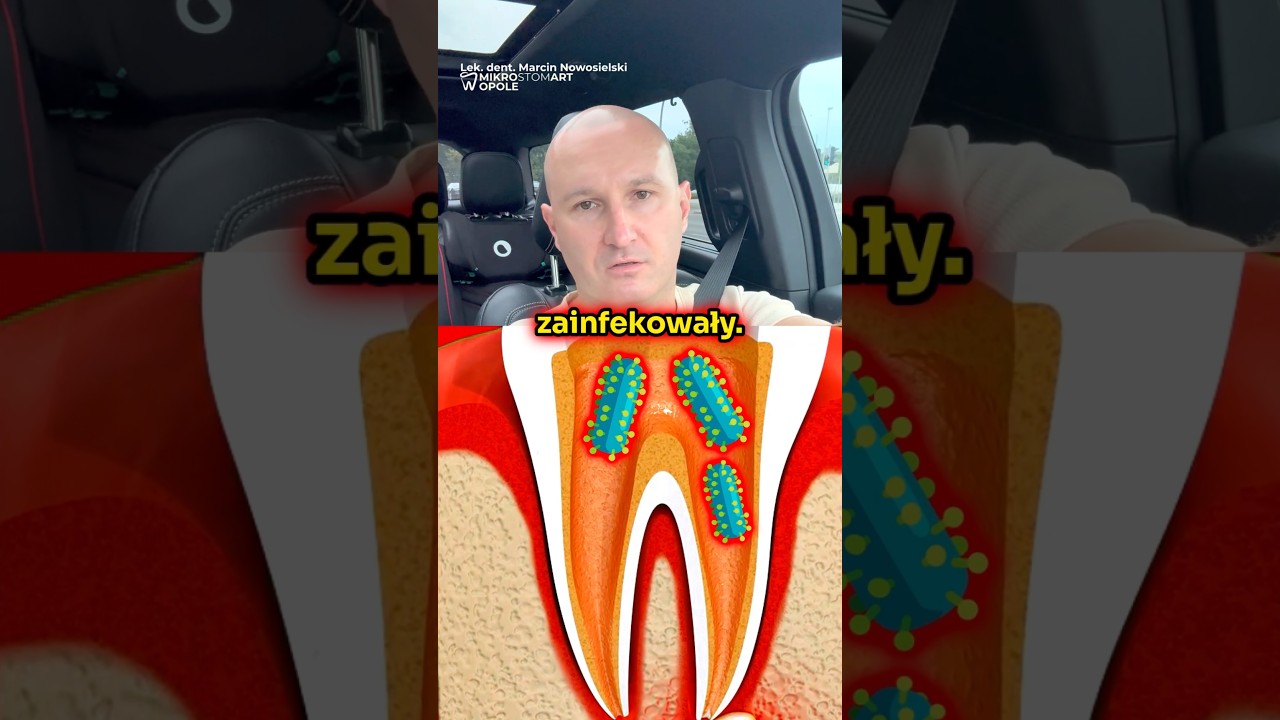 DOBRY ENDODONTA KOŃCZY... OD RAZU! 🦷⚡️ Dentysta: TYMCZASOWA PLOMBA = OTWARTE WROTA DLA BAKTERII!