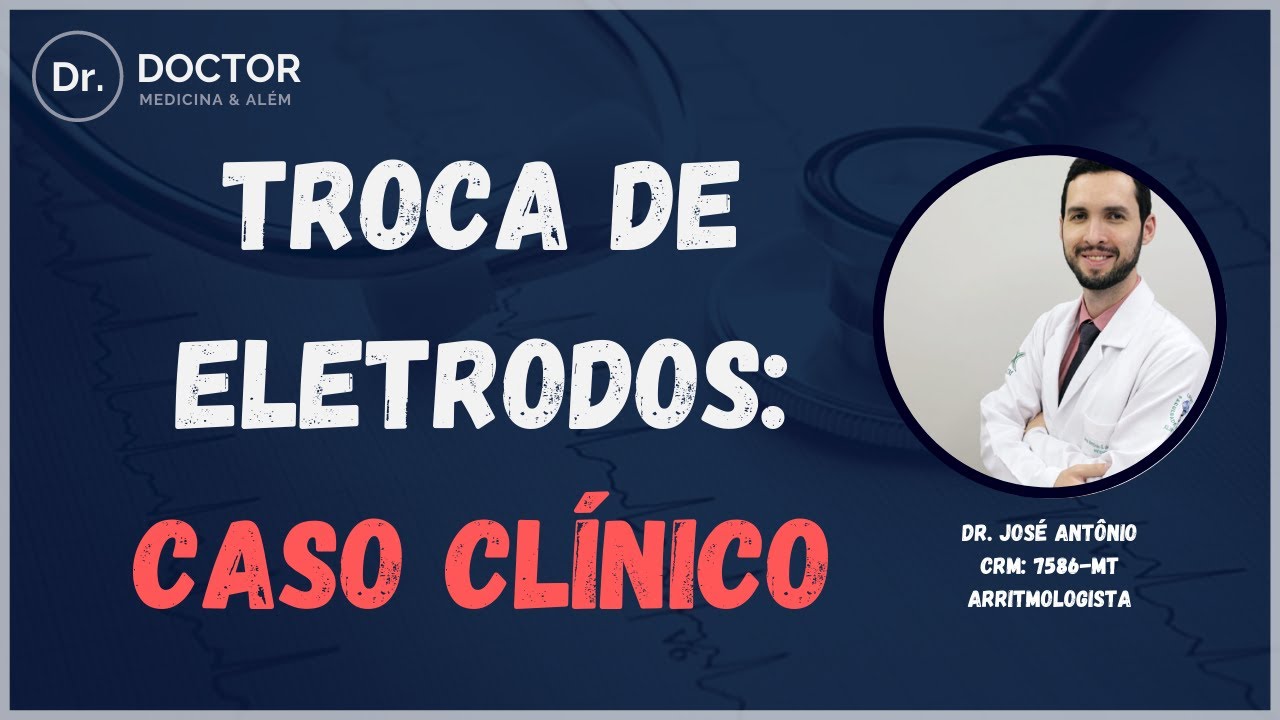 TROCA DE ELETRODOS: CASO CLÍNICO