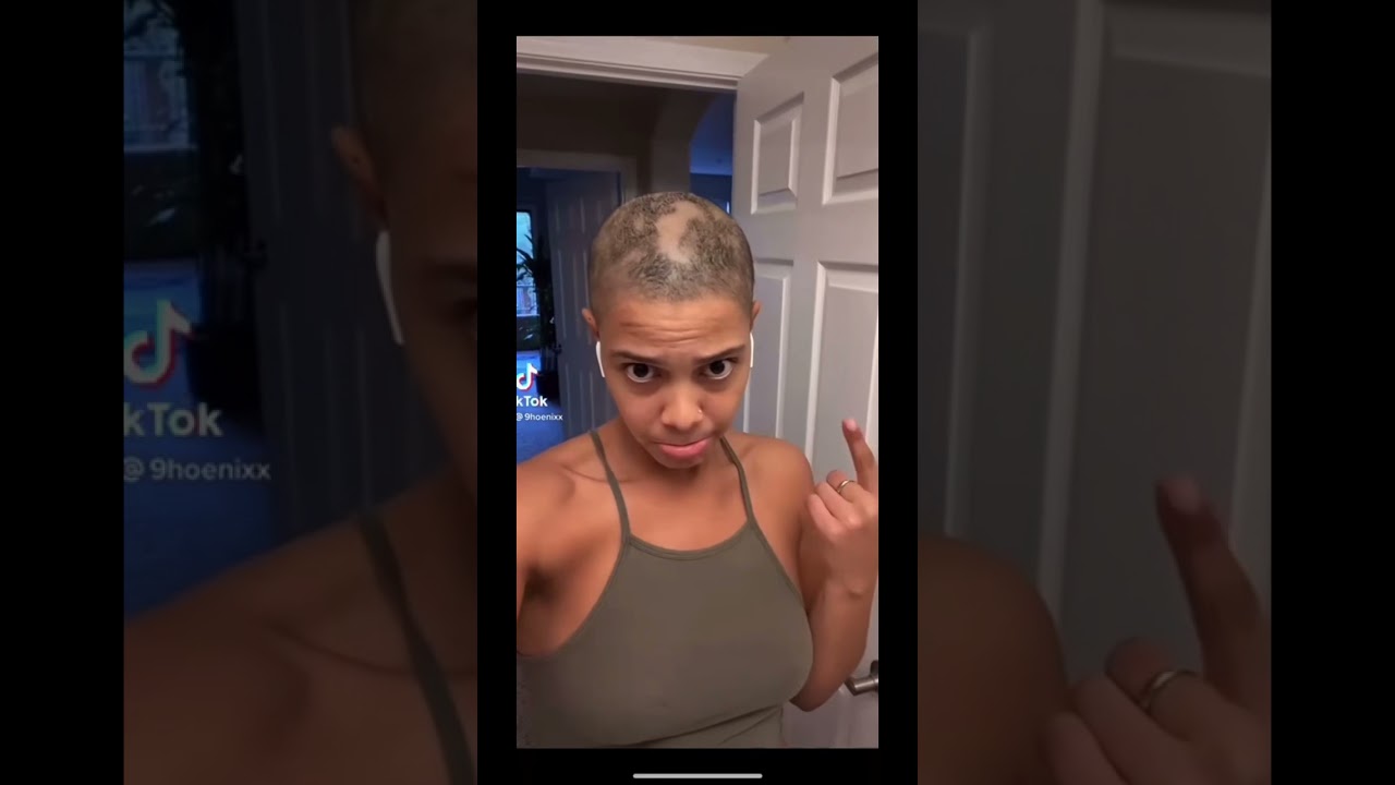 Women Scalpmicropigmentation Shaves Scalp Part #1