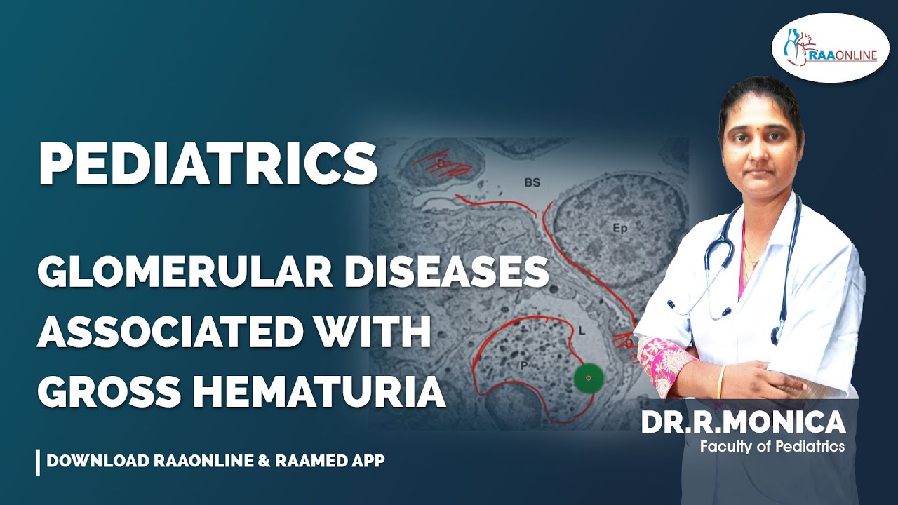 Pediatrics | Glomerular Diseases Associated with Gross Hematuria | Raaonline #pediatrics #nephrology