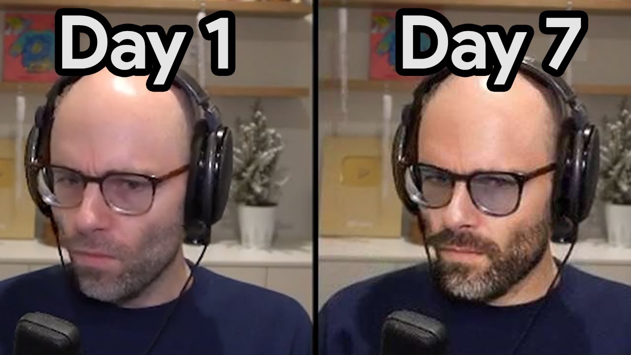 Northernlion is looksmaxxing