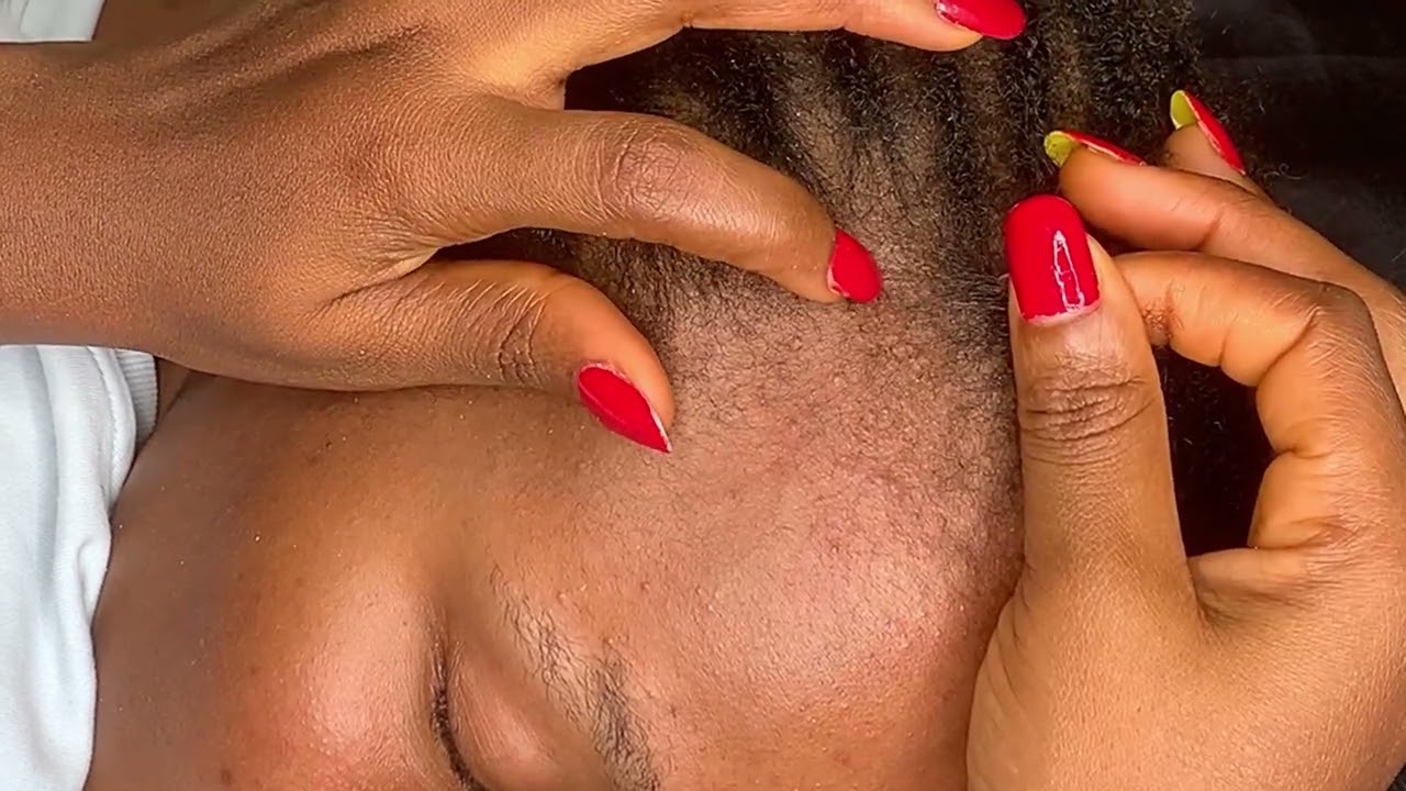 ASMR RARE SCALP SCRATCH FOR GOOD TINGLES | Well zoomed
