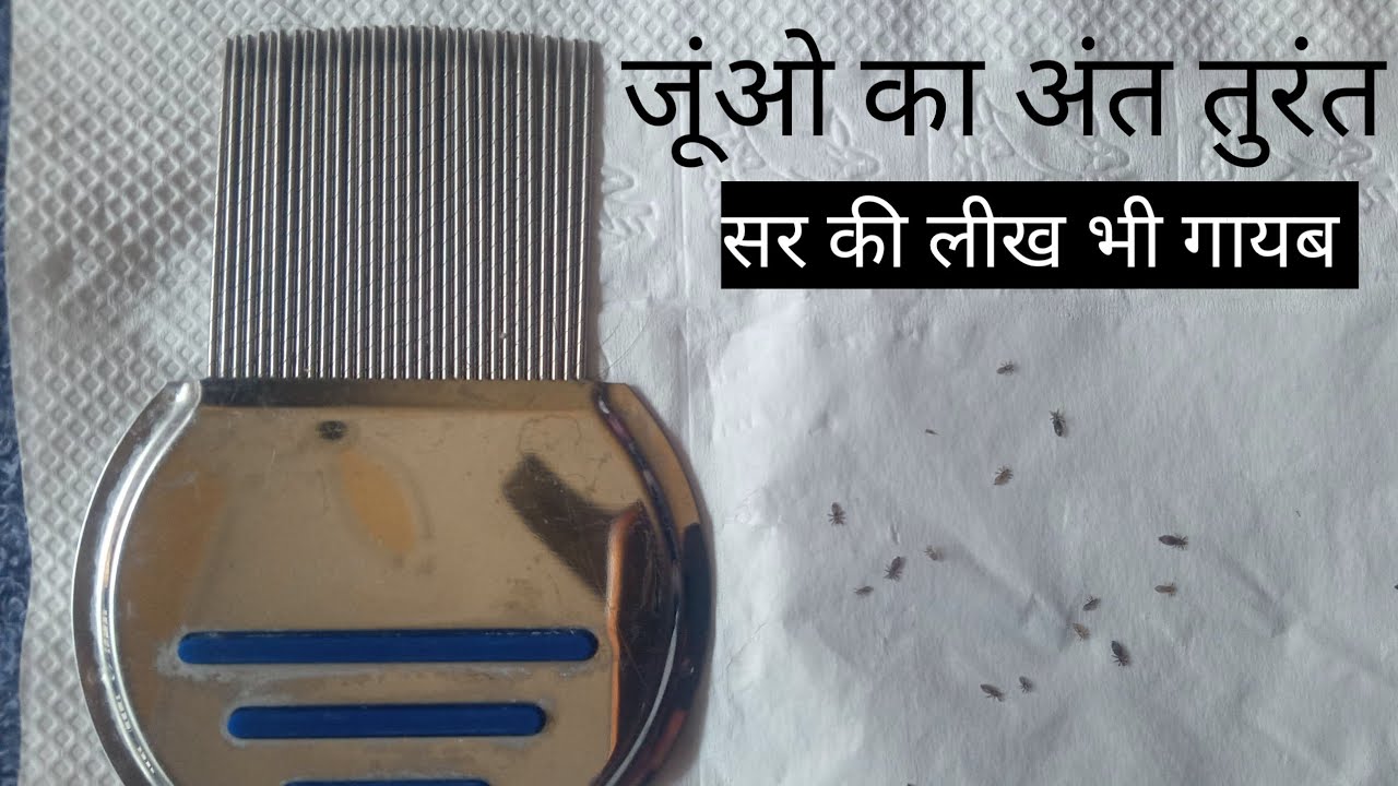 Steel comb।Anti lice Comb। जूं और लीख निकालने वाली कंघी।