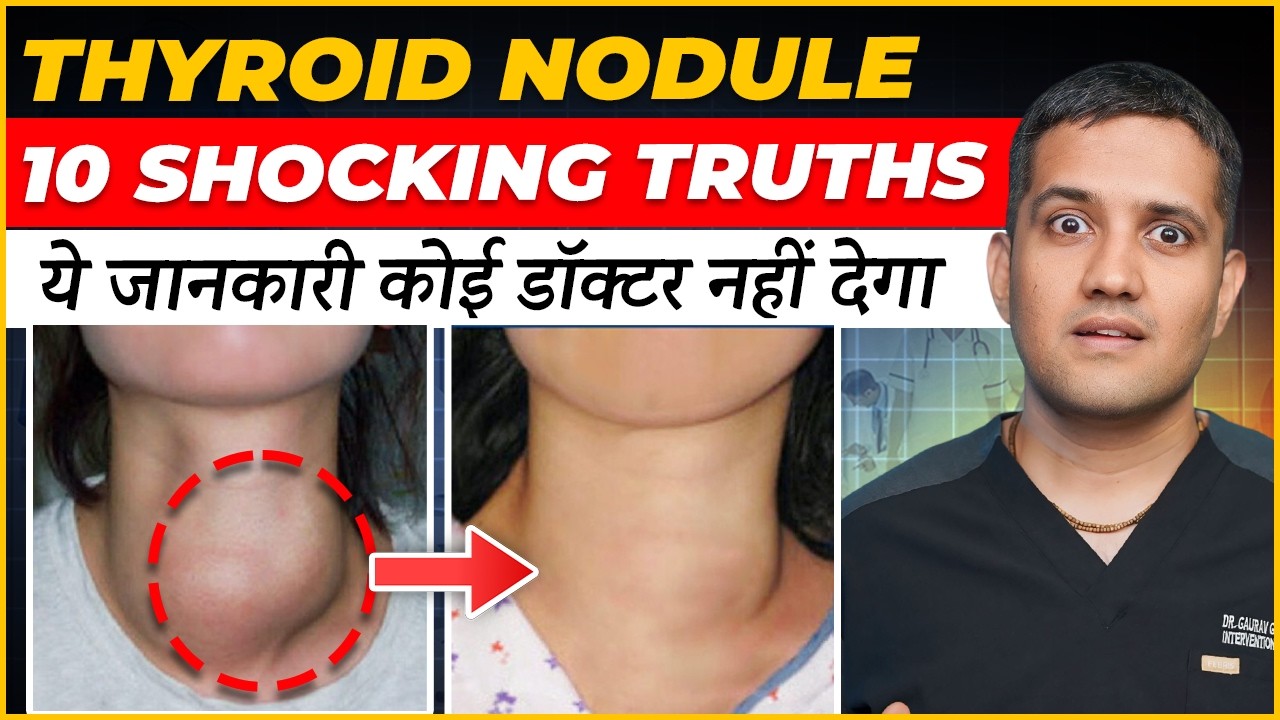 Thyroid Nodule Facts That No One Tells You | 10 Shocking Truths || Dr. Gaurav Gangwani