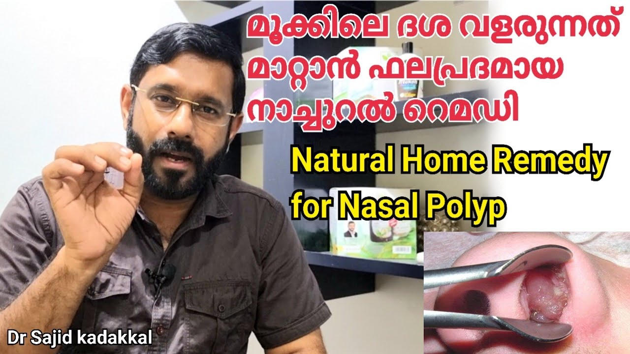 Natural Home Remedy for Nasal Polyp, മൂക്കിലെ ദശ വളരുന്നതിന് ഫലപ്രദമായ നാച്ചുറൽ ഹോം റെമഡി