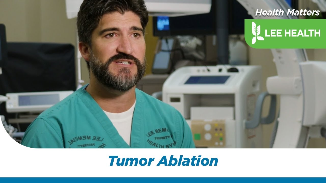 Tumor Ablation