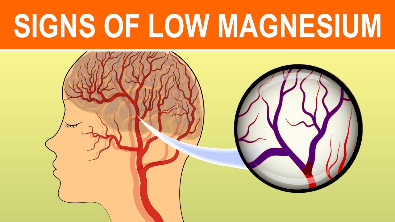 12 Signs Your Body Needs More Magnesium