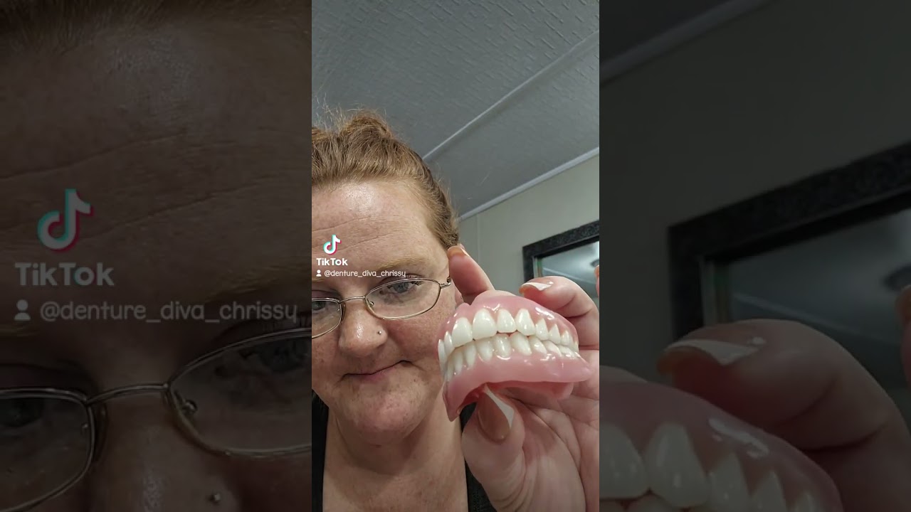 glue removal.after soaking #dentures #toothless #gummy #dental