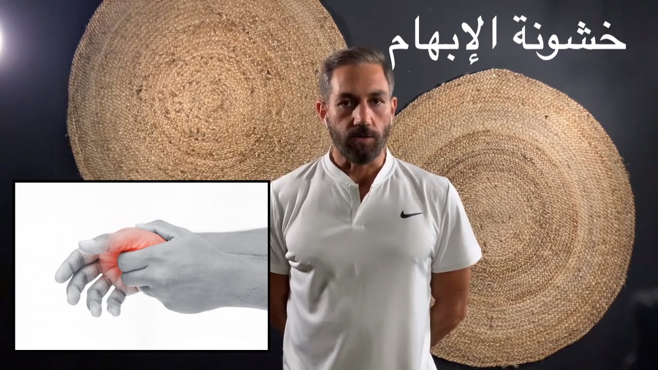 ٣٩ - آلام الابهام - خشونة مفصل الإبهام -  تمرين واحد كافي لأنهاء المعاناة -  rhizarthrose