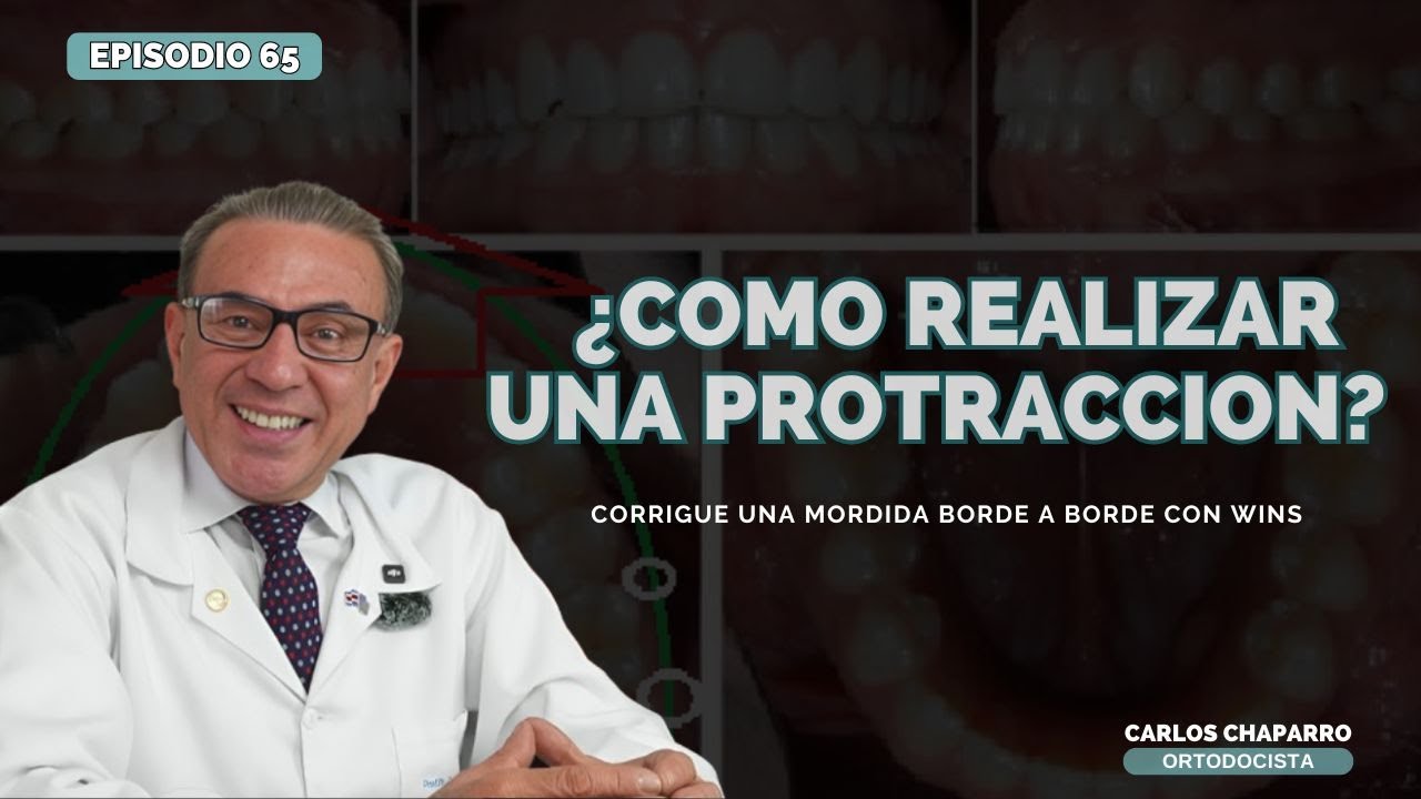 Protracción con Wins: Corregir una Mordida Borde a Borde- EPISODIO 65
