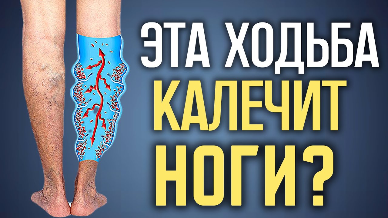 После 60 НЕЛЬЗЯ так ходить! Это разрушает здоровье и суставы!