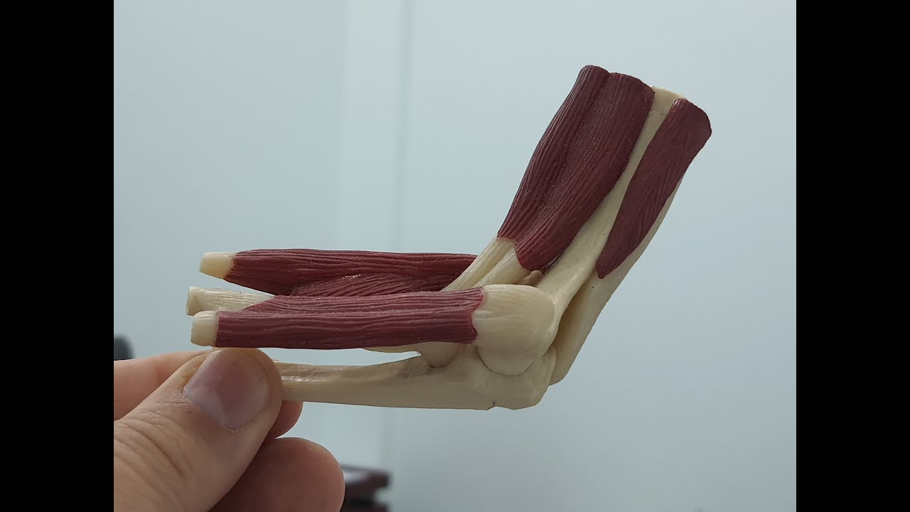 مرفق#الغولف من  #الدكتور عيى الجمل#جراحة العظام