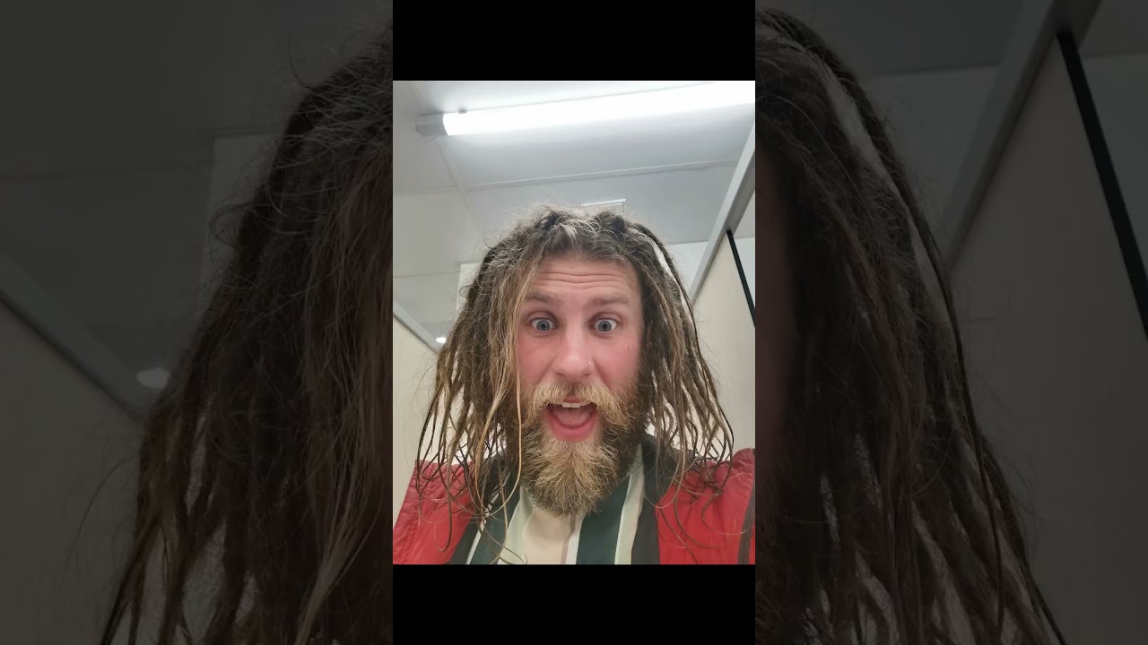 3 month dreadlock journey ( straight hair ) ( back comb and crochet method ) ( 111 baby dreads )