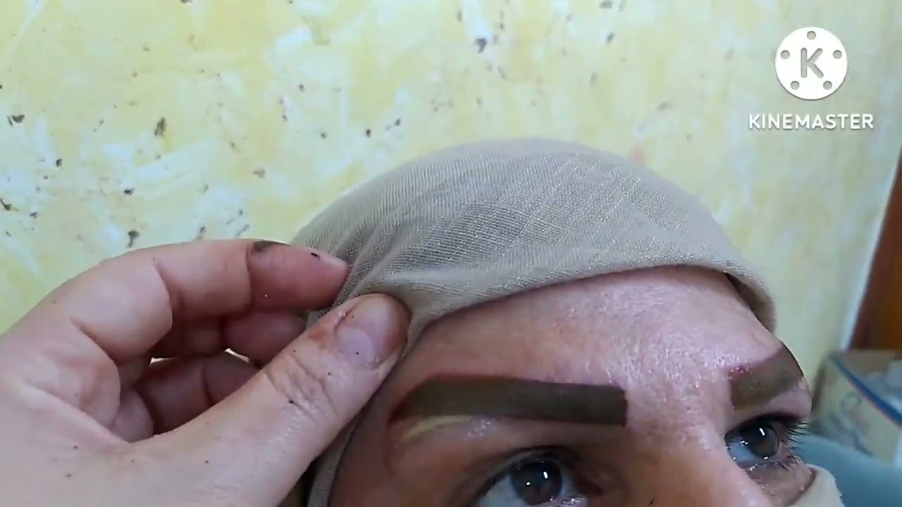 #مسح_وتغيير_لون_التاتو_بعد