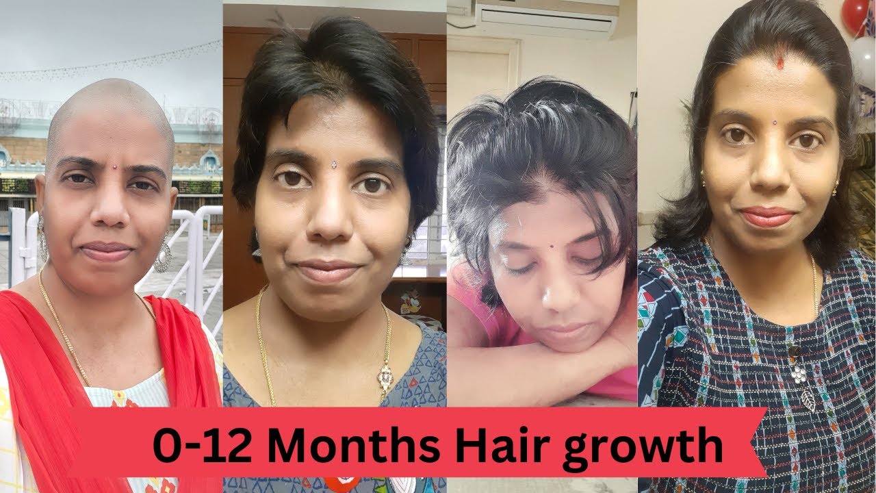 month 0 to month 12 hair growth || headshave || headshave  telugu