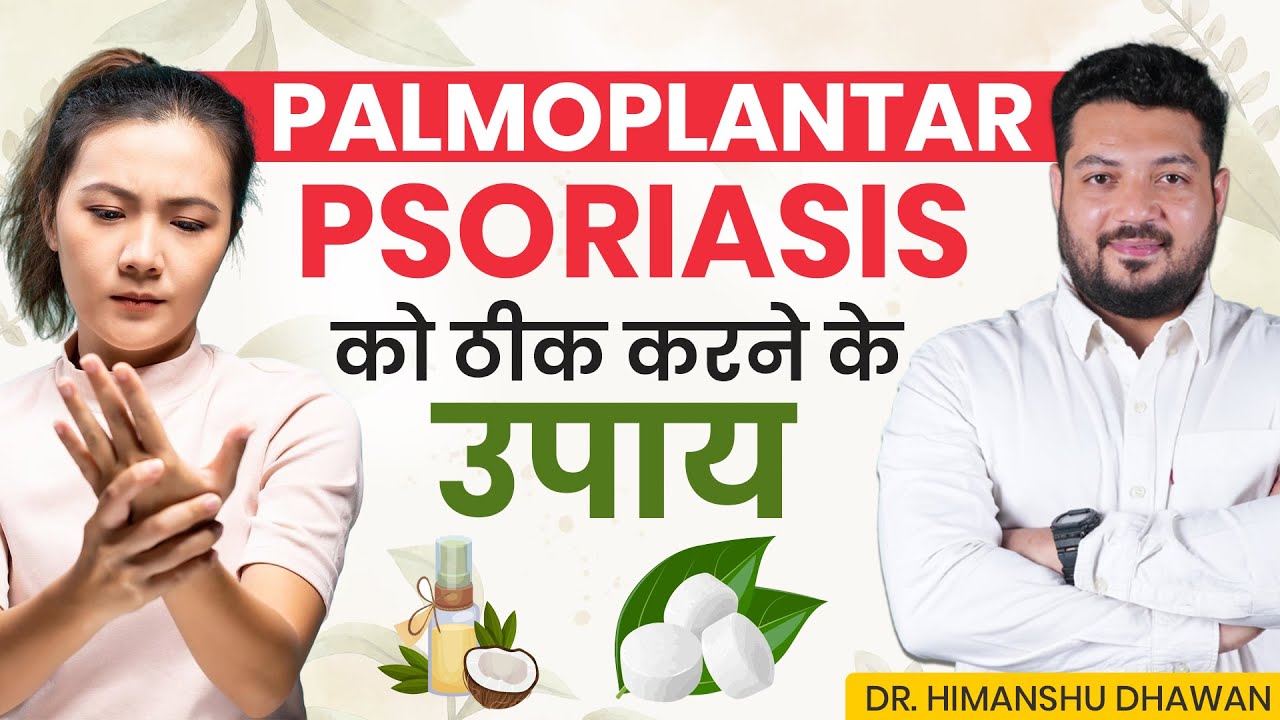 Palmoplantar Psoriasis ठीक करने  के घरेलू उपाय | Best Home Remedy for Palmoplantar Psoriasis
