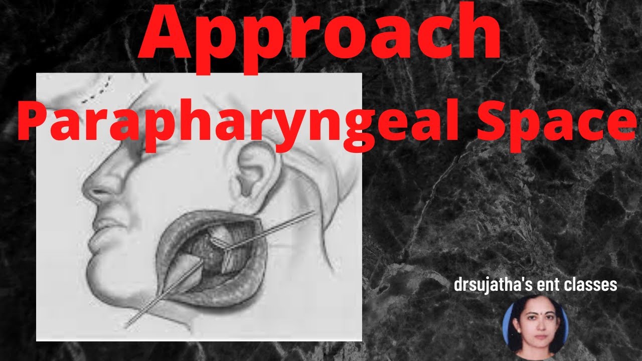 172.Approaches to parapharyngeal space 